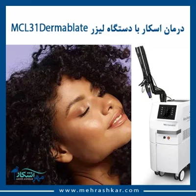 درمان اسکار با دستگاه لیزر MCL31 Dermablate