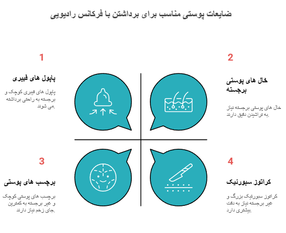 ضایعات و توده های پوستی مناسب برای برداشتن خال با فرکانس رادیویی