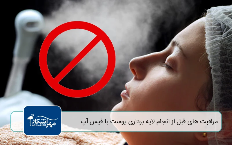 مراقبت‌ های قبل از انجام لایه برداری پوست با فیس‌ آپ
