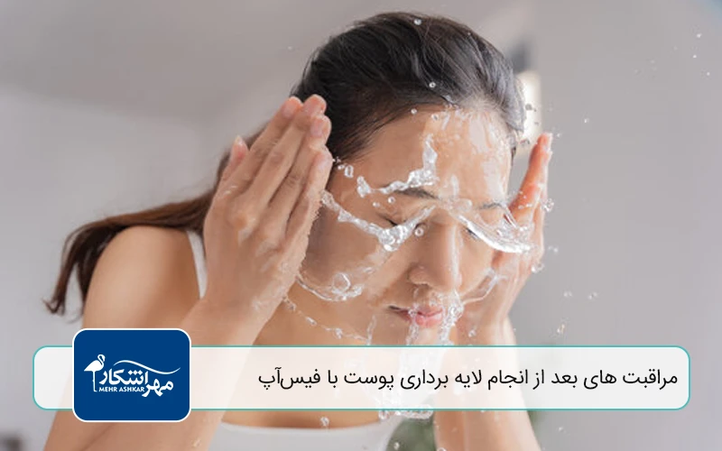 مراقبت‌ های بعد از انجام لایه برداری پوست با فیس‌ آپ
