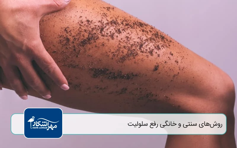 روش‌های سنتی و خانگی رفع سلولیت