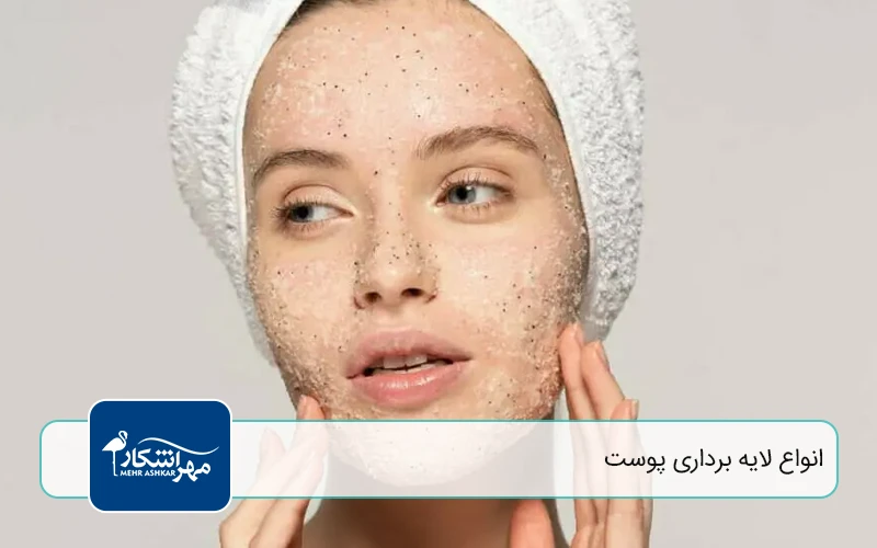 انواع لایه‌ برداری پوست
