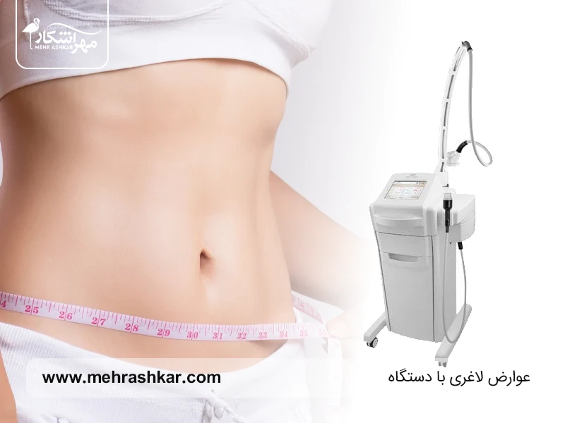 عوارض لاغری با دستگاه
