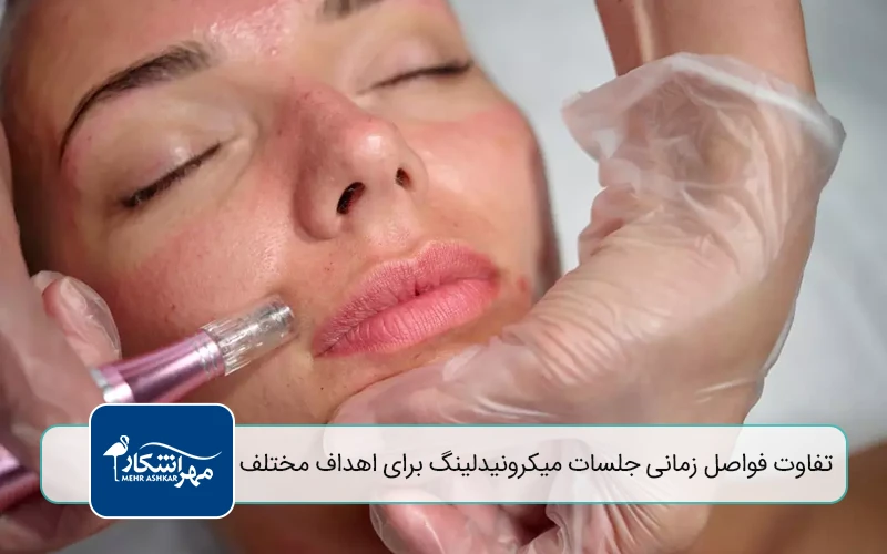 میکرونیدلینگ چیست و چگونه عمل میکند؟