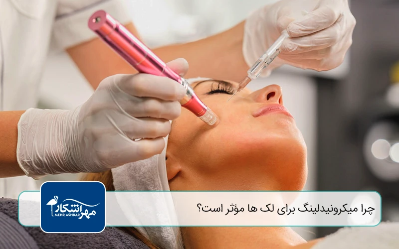 چرا میکرونیدلینگ برای لک ها مؤثر است؟